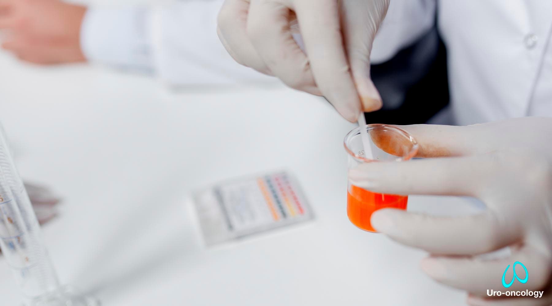 Diagnóstico de litiasis y cálculos en el sistema urinario