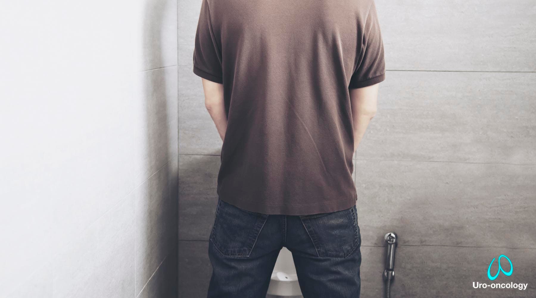 Estilo de vida saludable y factores de riesgo en urología