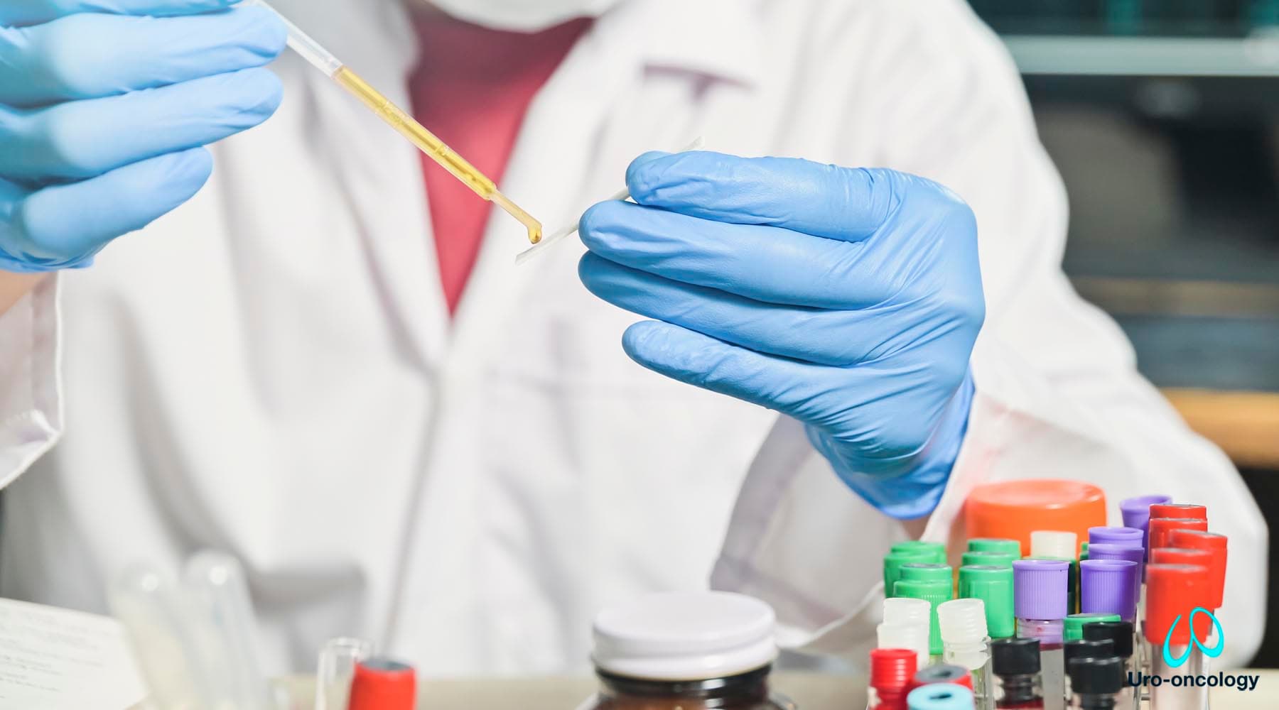 Dolor en la zona lumbar como posible síntoma de afección renal